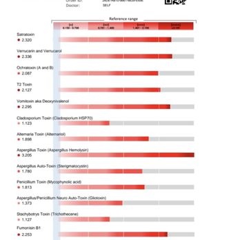 Las Casas Apartments - Blood Test for Mold Antibodies - Apartments Near Me - Tustin, California Las Casas Apartments - Blood Test for Mold Antibodies - Apartments Near Me - Tustin, California