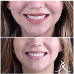 Valencia Advanced Dentistry at Copperhill Smiles - Cosmetic dentistry doesn't have to be drastic, simplicity is key.
