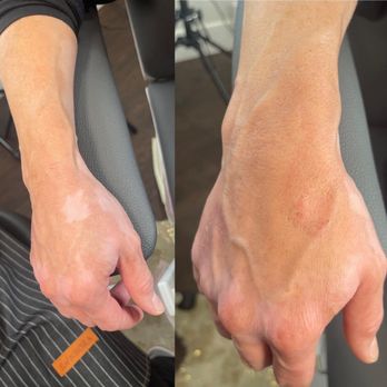 The Courtyard Salon - Scar Camouflage 1 session
By Julie
Forever Beauty - Hair Salons Near Me - Benicia, California The Courtyard Salon - Scar Camouflage 1 session
By Julie
Forever Beauty - Hair Salons Near Me - Benicia, California