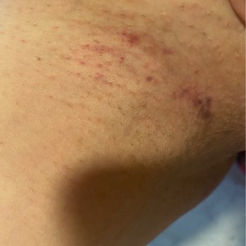 Sweet Peach Wax & Sugaring Studio - Sugaring Near Me - Atlanta, Georgia Sweet Peach Wax & Sugaring Studio - Sugaring Near Me - Atlanta, Georgia