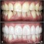Dentist Near Me Riverside