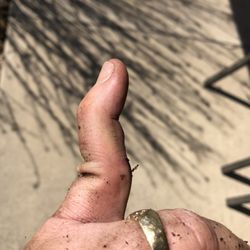 Royse City Urgent Care - Right after it happened
