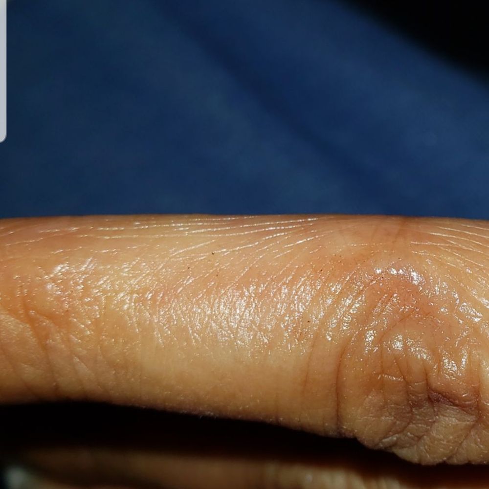 Terra Gaucha - Staff Member Burned Me With A Skewer - Brazilian Near Me - Tampa, Florida Terra Gaucha - Staff Member Burned Me With A Skewer - Brazilian Near Me - Tampa, Florida