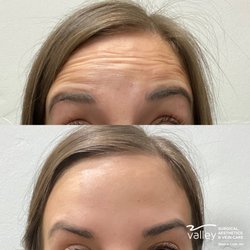 Brad A Case, MD - Valley Surgical Care Aesthetics