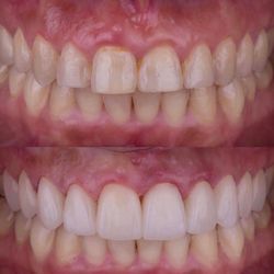Zen Dentistry