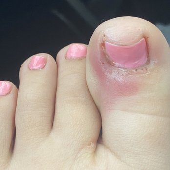 Diva's Nails - Infection on toe from pedicure - Nail Salons Near Me - Burbank, California