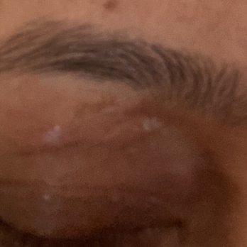 Jollys Threading & Waxing Salon - Cuts to the skin and swelling this is two hours after. - Threading Services Near Me - Yonkers, New York Jollys Threading & Waxing Salon - Cuts to the skin and swelling this is two hours after. - Threading Services Near Me - Yonkers, New York