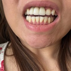 Pallavi Batra, DMD - Advanced Dentistry of Philadelphia