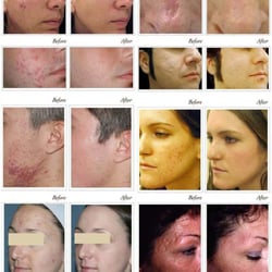 Taewon Moon MD - Laser Clinic & Plastic Surgery