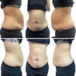 Claras Body Bar - 1st session