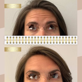 Arpèl Med Spa - Arpèl Med Spa - 4338 Tujunga Ave, Studio City, CA 91604 - (818) 927-4144 - Laser Hair Removal Near Me - Studio City, California