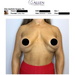 Allen Aesthetic Surgery