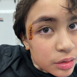 Stitches