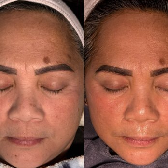 Skin Matters - Skin Care Near Me - Martinez, California Skin Matters - Skin Care Near Me - Martinez, California