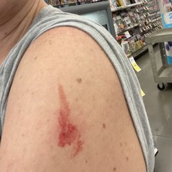 I went today to receive my Covid booster, this is how I left after the pharmacist administered the vaccine. Not even a bandaid!