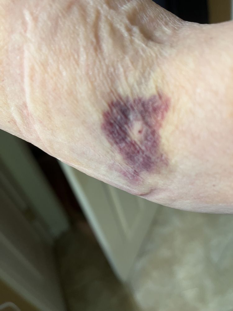 Candler Hospital - patient advocate in Savannah, GA