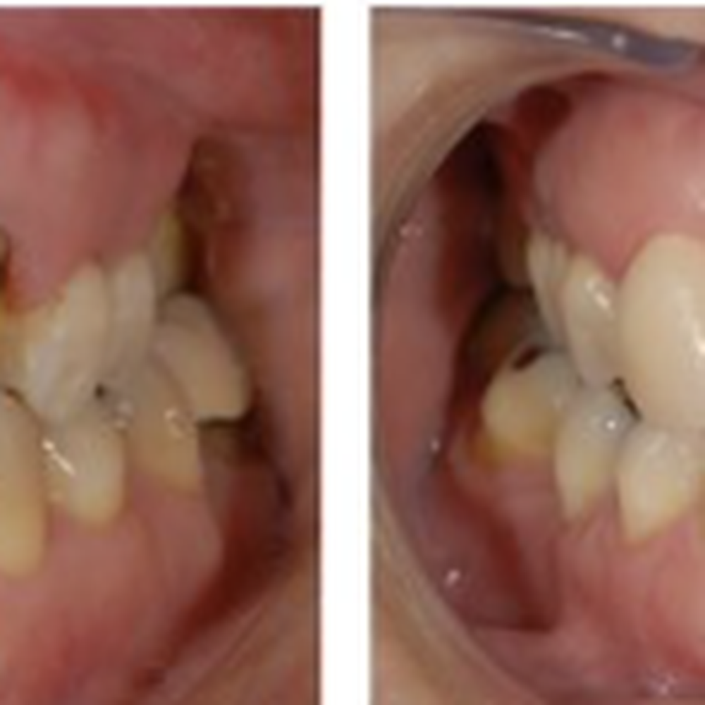 Duan Yu, DDS - General Dentistry Near Me - Oxnard, California Duan Yu, DDS - General Dentistry Near Me - Oxnard, California