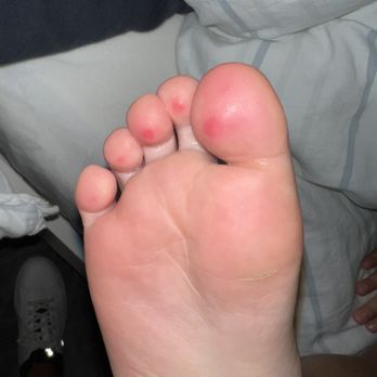 Mac Brother's Marble Dusting - His horrible work destroyed my kids and nieces feet. - Swimming Pools Near Me Mac Brother's Marble Dusting - His horrible work destroyed my kids and nieces feet. - Swimming Pools Near Me