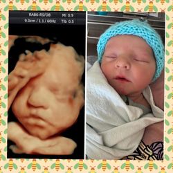 Belly Vision - A precious Belly Vision Baby