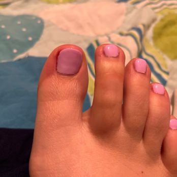 Nail Spa Expose - There is clearly a hole in the left corner of the big toe - Nail Salons Near Me - Webster, Texas