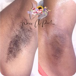 Waxx A Peel - Before and After Under Arm Waxx!