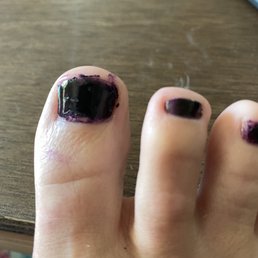 Worst pedicure ever Worst pedicure ever