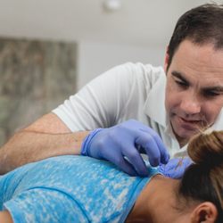 Move Empower Concierge Physical Therapy - Functional Dry Needling