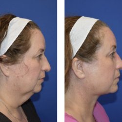 Yula Indeyeva, MD - Facial Plastic Surgery Of Austin