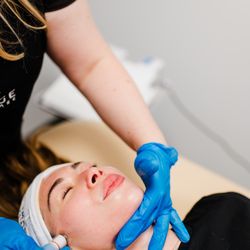 LEINE The Seattle Acne Clinic & Wellness Spa - HydroDermabrasion