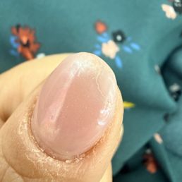 Terrible nails