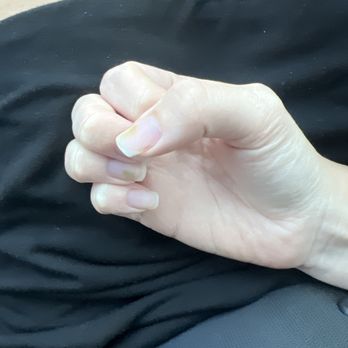Lavish Nails - Nail fungus. - Nail Salons Near Me - Vancouver, Washington