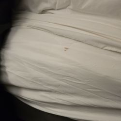 Good Nite Inn Camarillo - Dryed blood