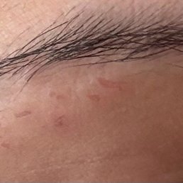 Cuts all across my brow and terrible shaping job too Cuts all across my brow and terrible shaping job too