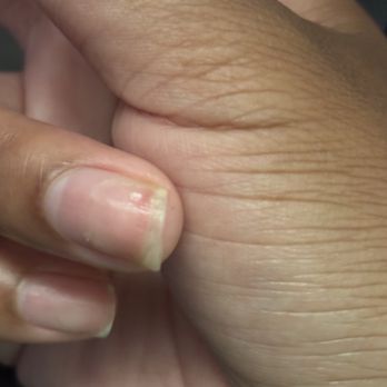 Zen Nail Bar - Red bruise inside my nail after soaking taking nails off - Nail Salons Near Me - La Habra, California