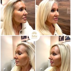 Solea Ageless Beauty