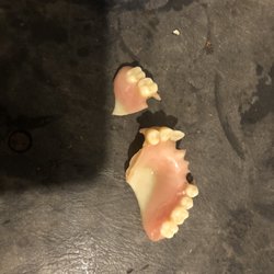 Dental Walk In Clinic of Tampa Bay - Broken denture.