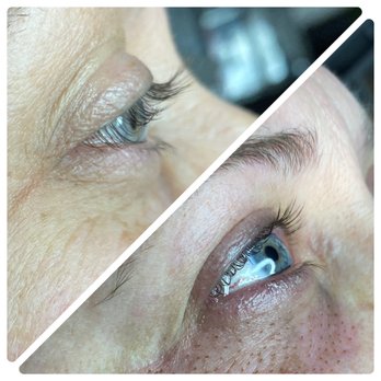 Face It Aesthetics - Fibroblast Skin Tightening - Waxing Near Me - Tucson, Arizona Face It Aesthetics - Fibroblast Skin Tightening - Waxing Near Me - Tucson, Arizona