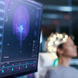 Neurofeedback Maui - QEEG/BrainMapping analysis and Neurofeedback