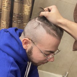 WORLDS WORST HAIRCUT