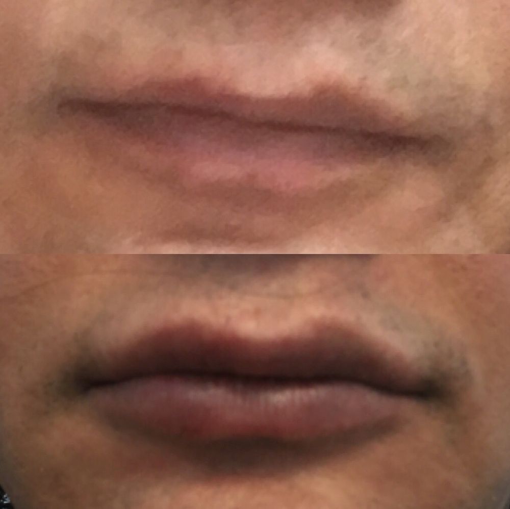 CALIFORNIA SKIN CENTER Updated October 2024 29 Photos & 10 Reviews