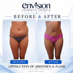Envision Cosmetic Surgery: Dr. Benjamin Dunkley