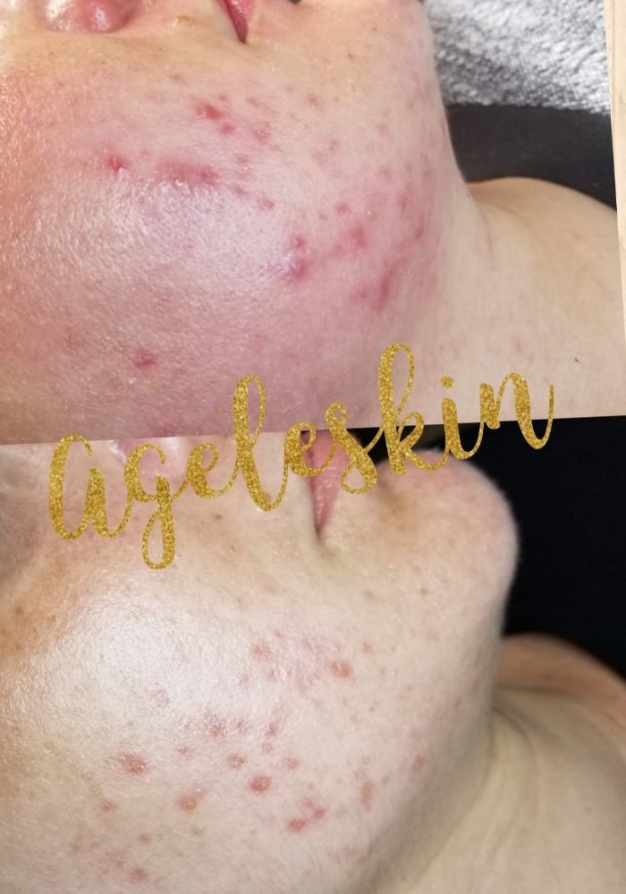 Ageleskin Logo