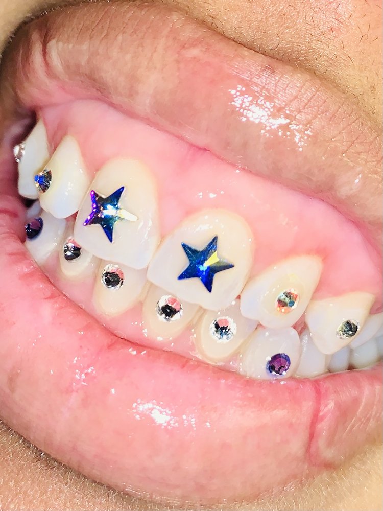 MR GLITZ THE TOOTH JEWELER Updated September 2024 5388 Knight