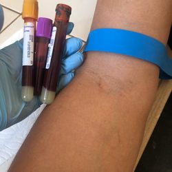 Mobile Blood Services - Vials taken of a blood draw from a mobile patient
