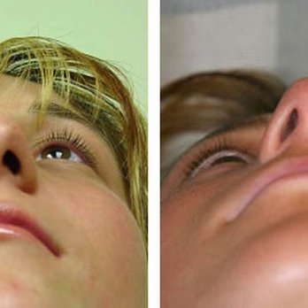 Michael A. Bain, MD - Plastic Surgeons Near Me - Newport Beach, California