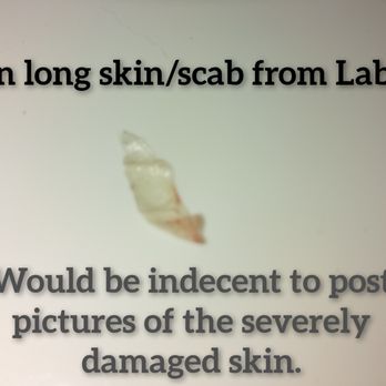 Viana Salon & Spa - 2in long blister scab from the damage to my labia... Photo's of the horrific damage to my labia would be indecent. - Waxing Near Me - Jacksonville, Florida