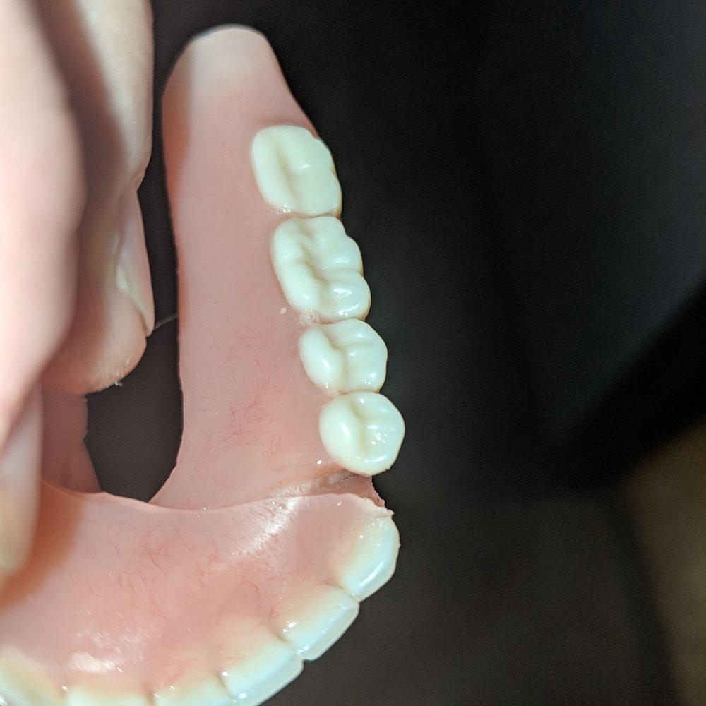 Aspen Dental - Mattoon, IL - Poorly manufactured dentures due to negligence and malpractice - Oral Surgeons Near Me - Mattoon, Illinois
