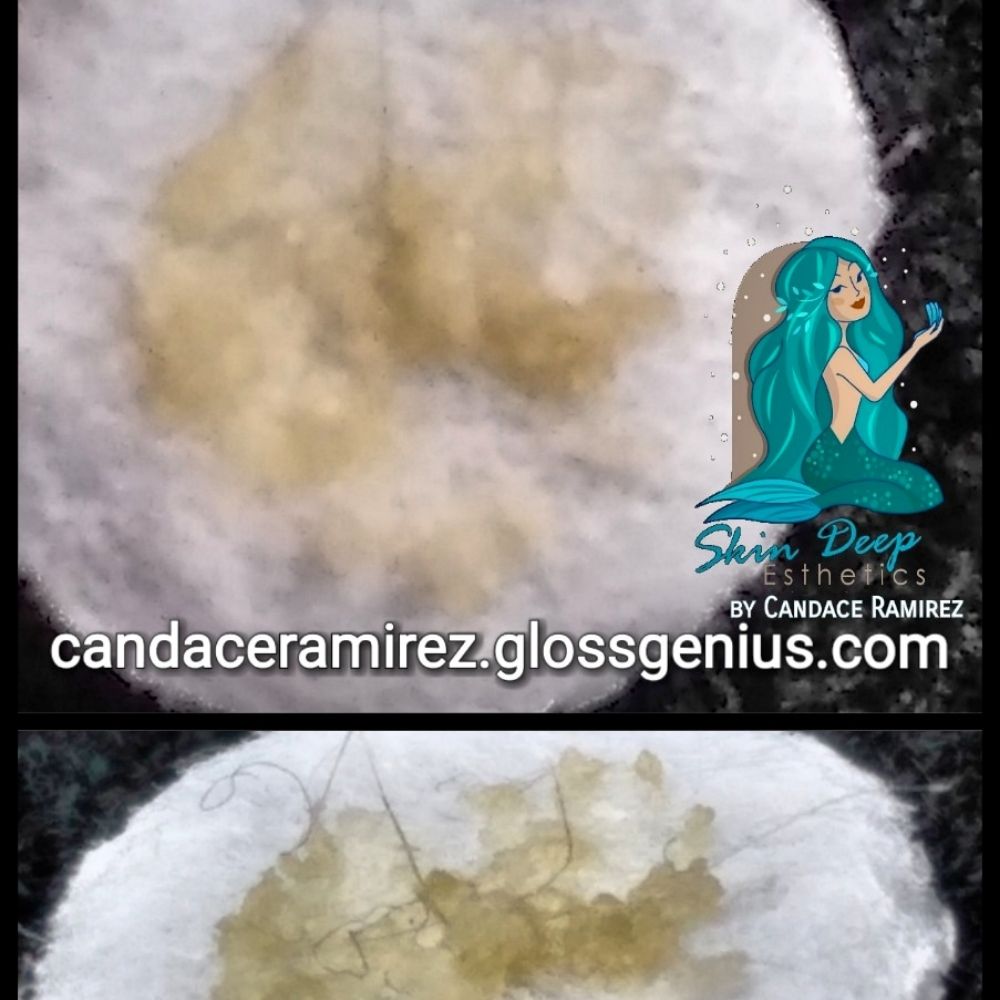 Skin Deep Esthetics By Candace Logo