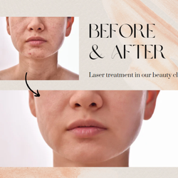 Dew Aesthetics & Wellness - Laser facials available in Kansas City and Shawnee. Call (913) 368-9246 for a free consultation. We are happy to answer any questions.