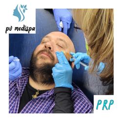 PV MediSpa - Under-eye PRP treatment